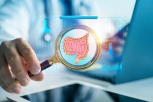 λαπαροσκοπική κολεκτομή