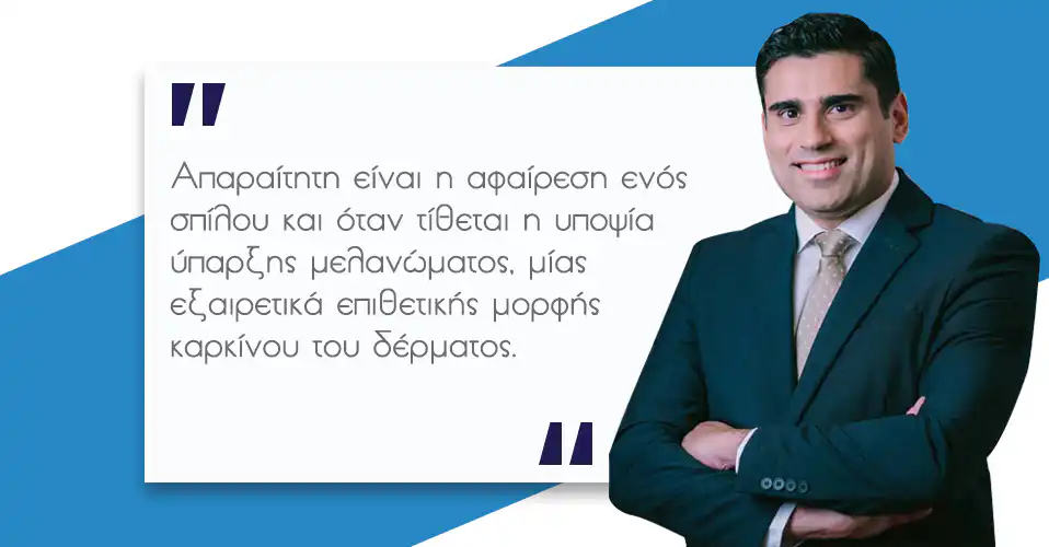 Σπίλοι - Πότε πρέπει να αφαιρούνται