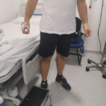 Βουβωνοκήλη: Αίτια, Θεραπεία, Κόστος και Σύγχρονες Τεχνικές 5